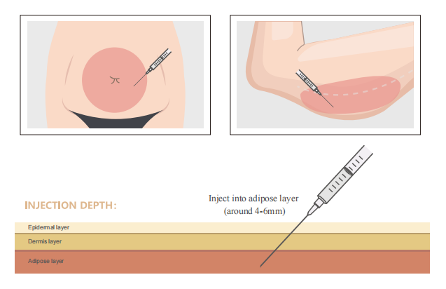 Semaglutide Mechanism of Action Semaglutide Mechanism of Action