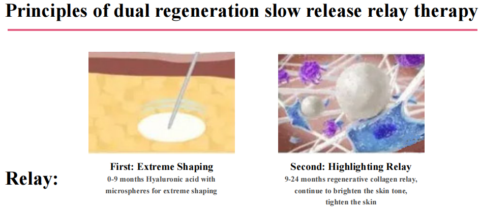 How PLLA Filler Works How PLLA Filler Works