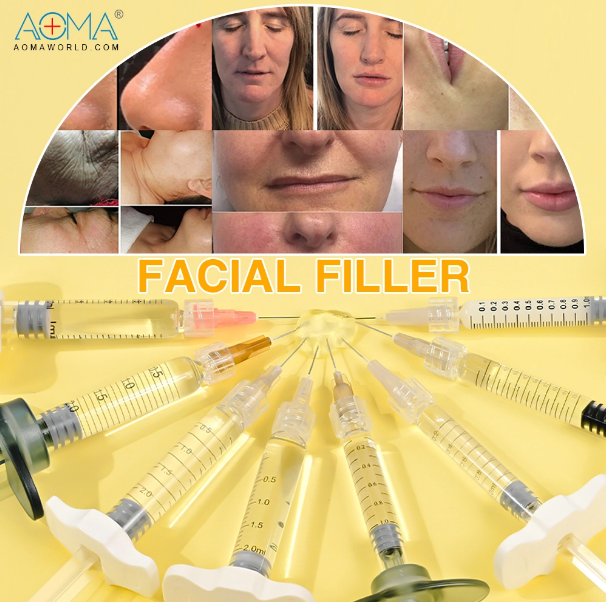 Facial filler option Facial filler option