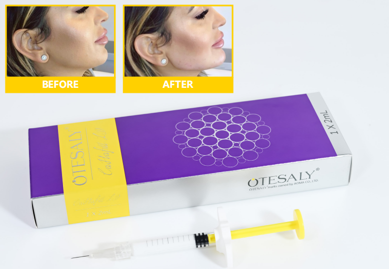 CaHafill LD CaHafill LD