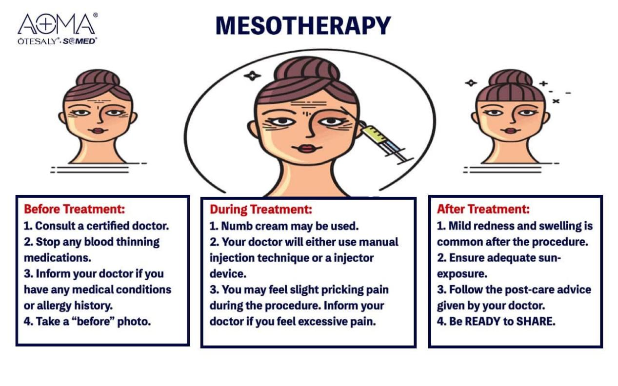 AOMA dos and donts after Mesotherapy