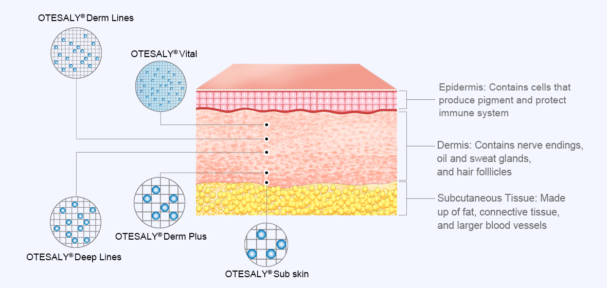 Dermal Filler Area