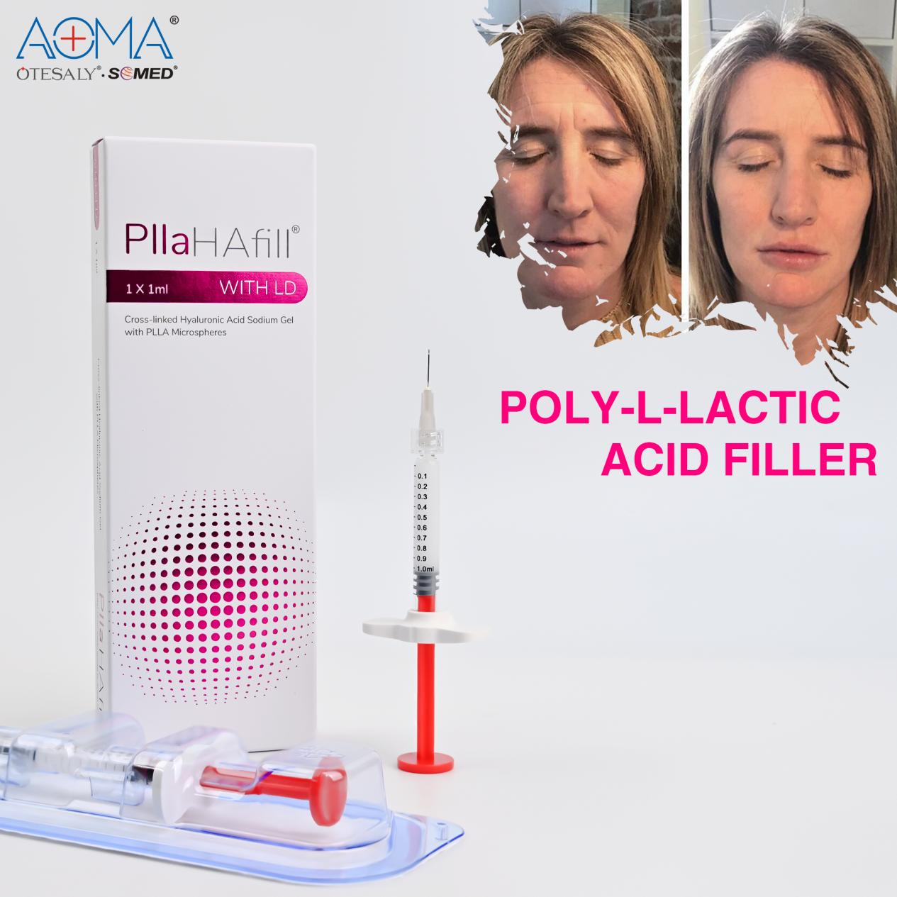 PLLA HA FILLER