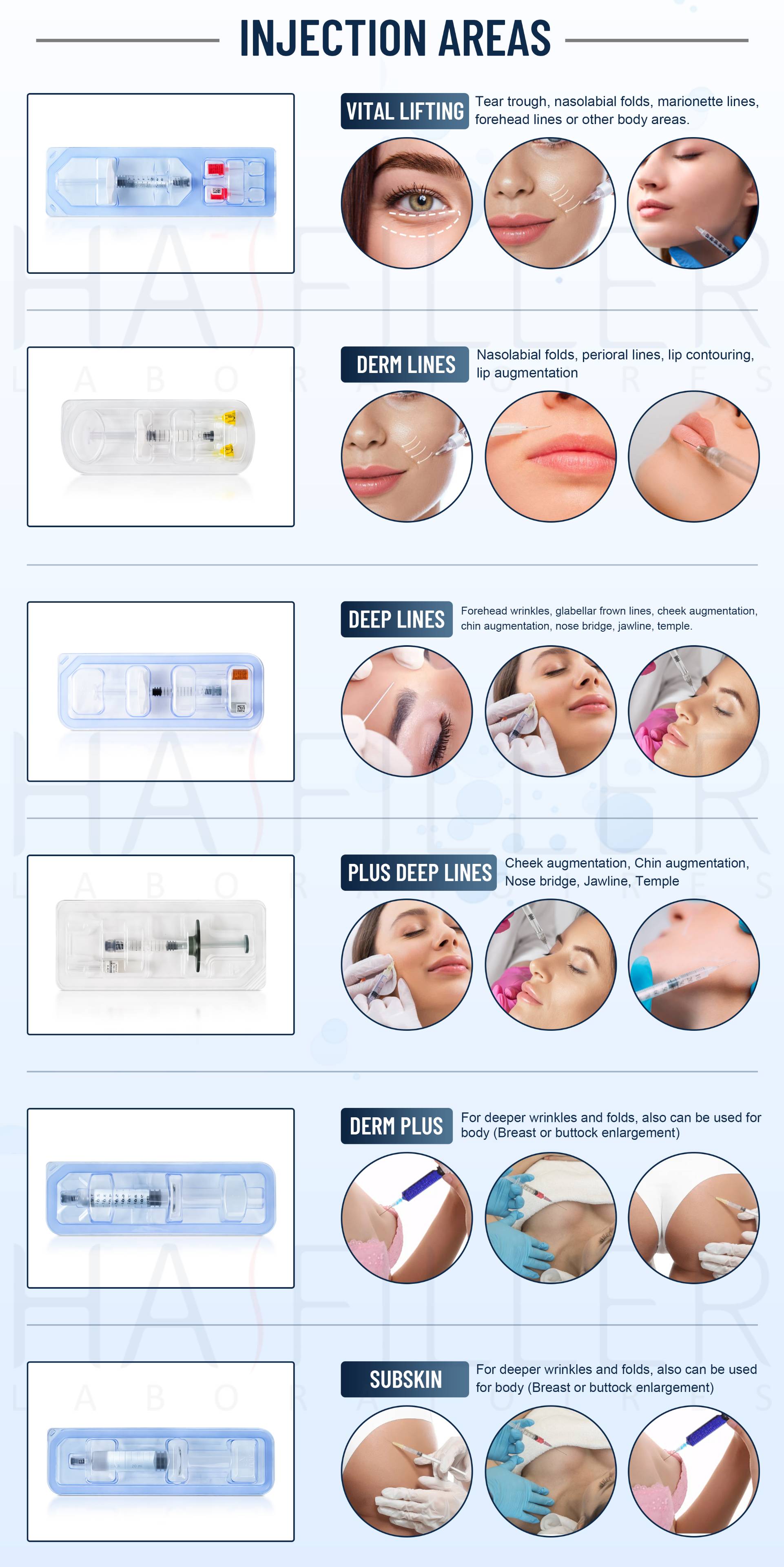 Hyaluronic acid filler injection area