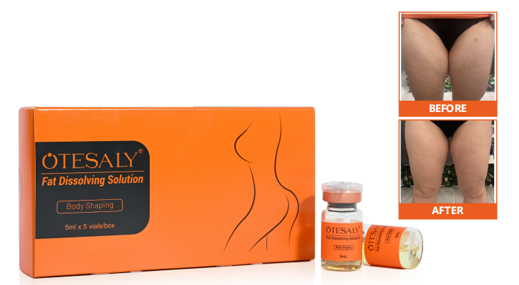 AOMA Fat Dissolving Solution