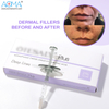 Customized Plus 1ml Hyaluronic Acid Facial Dermal Filler Jawline