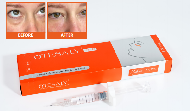 AOMA Skin Booster Injections