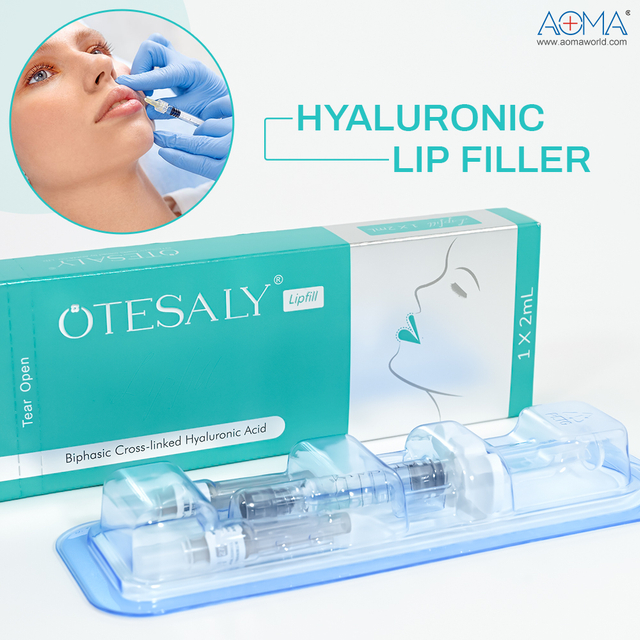 2ml Υαλουρονικό Οξύ Lips Filler για αύξηση όγκου χειλιών & αποτέλεσμα παχύρρευστου