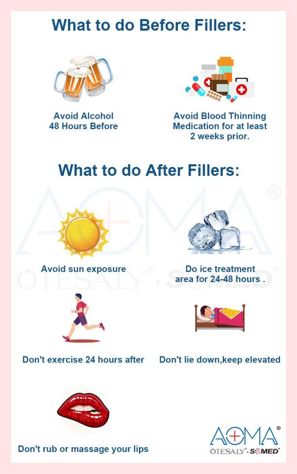 What to do Before Dermal Fillers