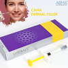 Non Animal 2ml Calcium Hydroxyapatite Filler Nasolabial Folds Injection