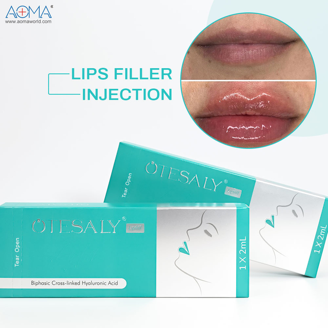 2ml OEM Lips Filler for Lip Enhancement Κατασκευαστής OEM