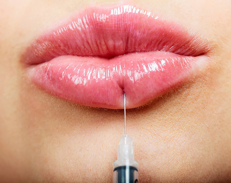 Lip Augmentation Injection.png