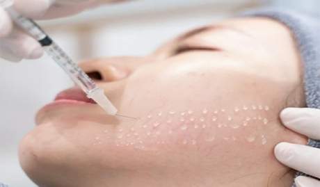 मेसोथेरेपी गोद लैने च क्षेत्रीय स्पॉटलाइट_ विचलित मार्ग।jpg