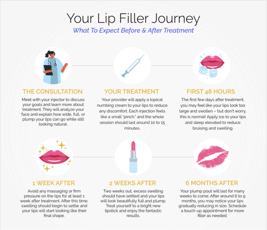 AOMA What to do before, during and after lip filler treatment