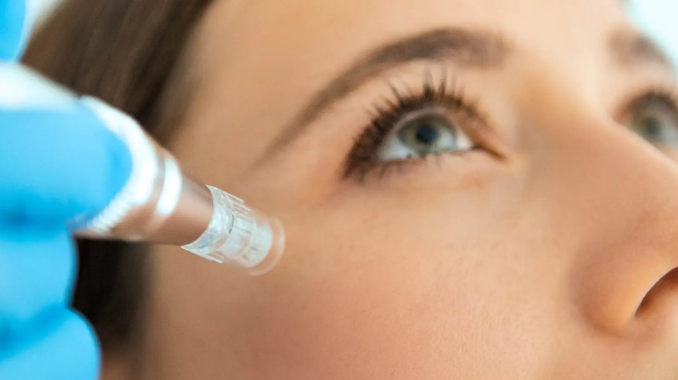 中胚层疗法解决方案