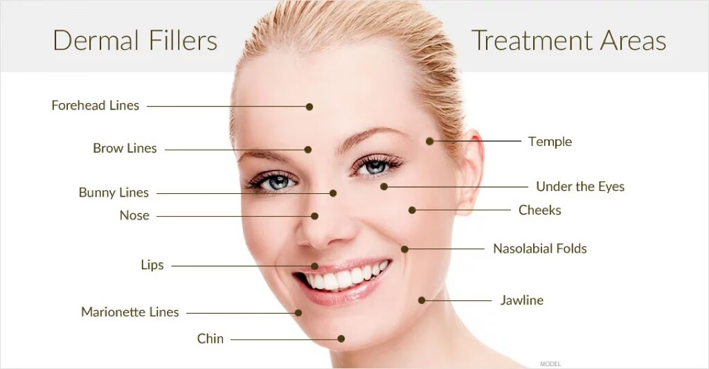 Facial Areas for Dermal Fillers