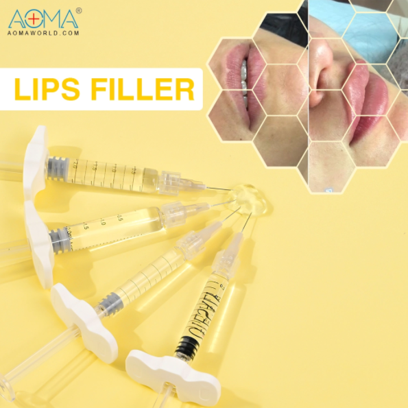 什么是唇部填充剂