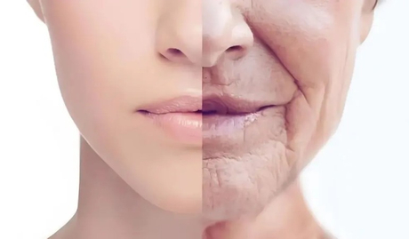 Lip Volume & Perioral Rejuvenation A Long-Term HA Filler Case Study on Lips.jpg