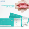 2ml Cross-Linked HA Lips Filler | Natural Lip Contouring & Smoother Texture