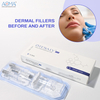 Biphasic 2ml Lidocaine Mo ƒe Filler Glabellar brown fliwo .