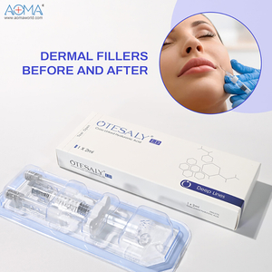 Biphasiv 2ML Lidocaine Facial Filler Flower Glabellar Globallar