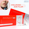 2ml Lidocaine Ansigtsinjection for Chin Augmentation Volume ODM Producent