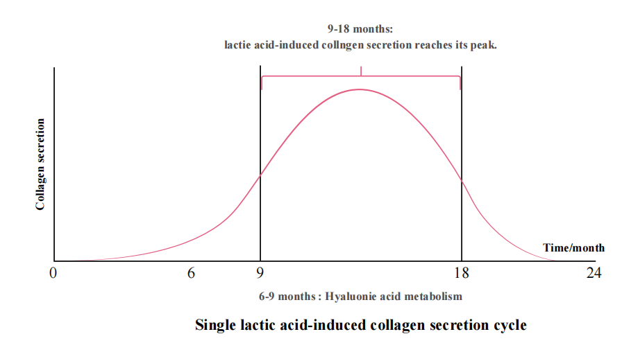 Duration of PLLA Filler