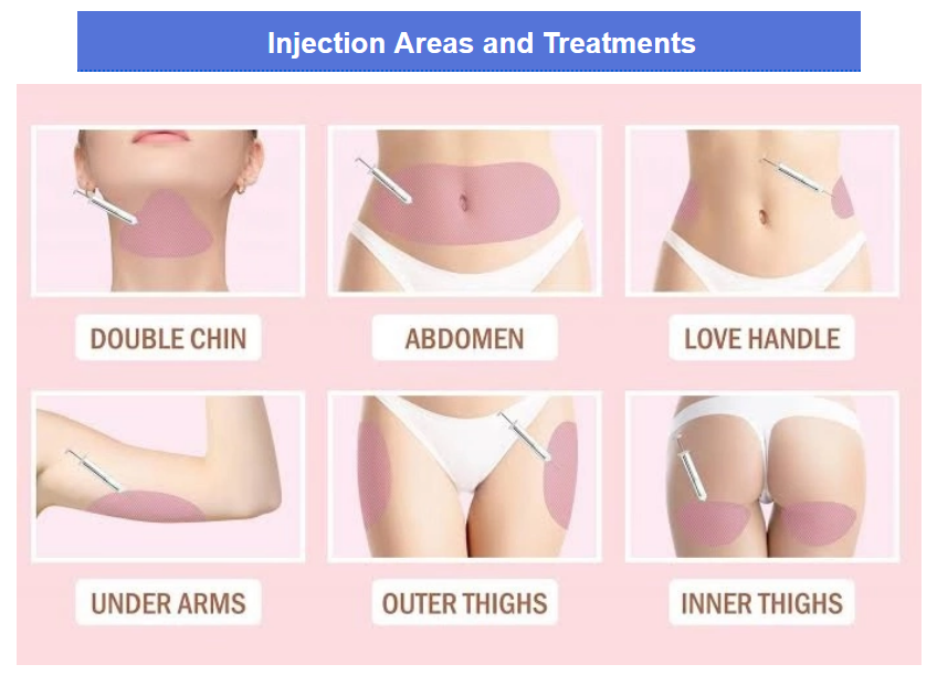 Fat Dissolving Injection Areas