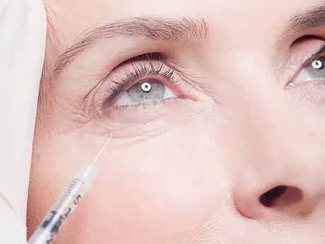 Tear Trough Filler Safety Precautions What to Expect.png