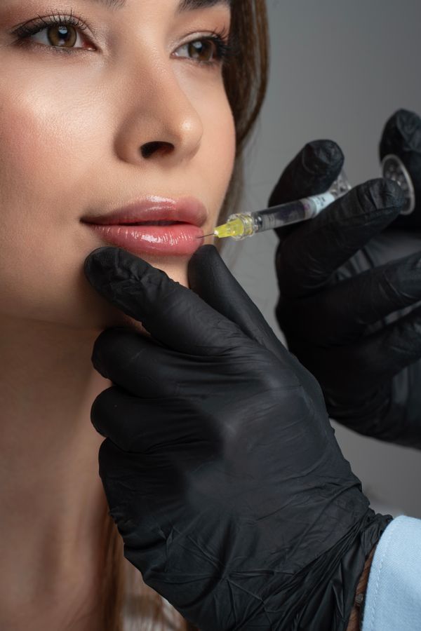 Procediment cosm&egrave;tic Injecci&oacute; de farciment d&egrave;rmic &middot; Foto d'estoc gratu&iuml;ta