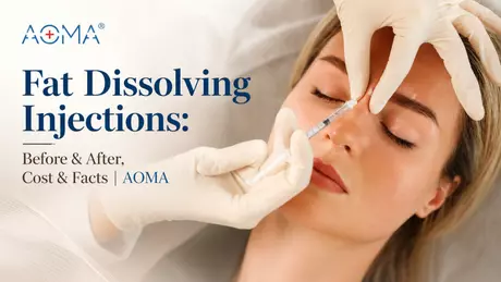 A Full Guide to Lipo Lab Fat Dissolving.webp