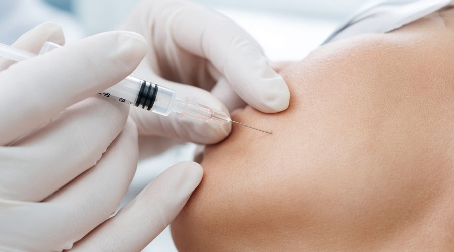 Gloved practitioner performing an intradermal microinjection on the cheek with a fine insulin needle